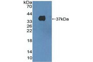 Detection of Recombinant HGFR, Human using Polyclonal Antibody to C-Met (MET) (c-MET 抗体  (AA 1092-1379))