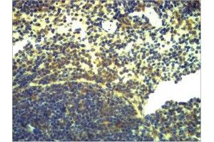 Immunohistochemical analysis of paraffin-embedded Mouse Spleen Tissue using TLR2 Polyclonal Antibody. (TLR2 抗体)
