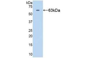 Detection of Recombinant HSPD1, Human using Polyclonal Antibody to Heat Shock Protein 60 (Hsp60) (HSPD1 抗体  (AA 1-573))