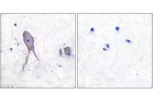 Immunohistochemistry analysis of paraffin-embedded human brain tissue, using Notch 2 (Cleaved-Asp1733) Antibody. (NOTCH2 抗体  (Cleaved-Asp1733))