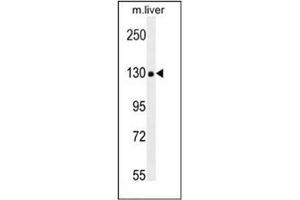 Western blot analysis in mouse liver tissue lysates (35ug/lane) using COL18A1 Antibody (Center) Cat. (COL18A1 抗体  (Chain alpha 1, Middle Region))