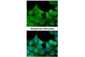 ICC/IF Image Immunofluorescence analysis of paraformaldehyde-fixed A431, using EXOC7, antibody at 1:200 dilution. (EXOC7 抗体)