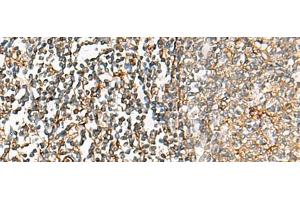 Immunohistochemistry of paraffin-embedded Human tonsil tissue using CHKA Polyclonal Antibody at dilution of 1:35(x200) (Choline Kinase alpha 抗体)