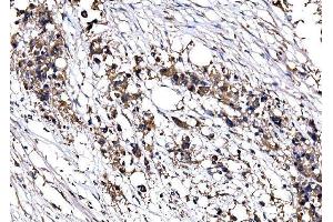 IHC analysis of IMPDH1 using anti-IMPDH1 antibody (ABIN7599864).