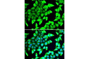 Immunofluorescence analysis of A549 cells using HDAC5 antibody. (HDAC5 抗体)