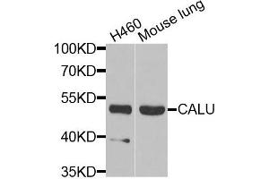 Western blot analysis of extracts of H460 and mouse lung cells, using CALU antibody. (CALU 抗体)