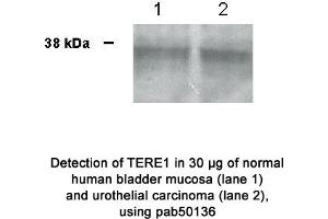 Image no. 1 for anti-UbiA Prenyltransferase Domain Containing 1 (UBIAD1) (N-Term) antibody (ABIN363445) (UBIAD1 抗体  (N-Term))