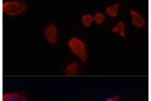 Immunofluorescence analysis of HeLa cells using CA9 Polyclonal Antibody at dilution of 1:100. (CA9 抗体)