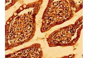 Immunohistochemistry of paraffin-embedded human small intestine tissue using ABIN7146314 at dilution of 1:100 (MCU 抗体  (AA 155-233))