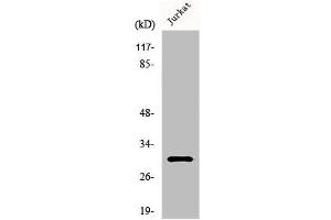 Western Blot analysis of K562 cells using HoxD12 Polyclonal Antibody (HOXD12 抗体  (C-Term))