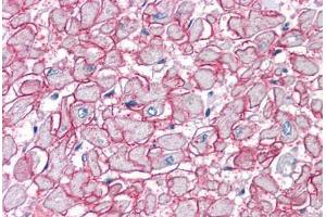 Human Heart: Formalin-Fixed, Paraffin-Embedded (FFPE) (SGCB 抗体  (AA 87-197))