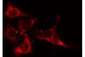 ABIN6275132 staining MCF7 cells by IF/ICC. (ALDOB 抗体  (C-Term))