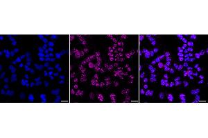 Immunocytochemical staining of HeLa cells with Phospho-ErbB2 (Y) antibody (ABIN7800159), 1:1,000). (Recombinant ErbB2/Her2 抗体  (pTyr1139))