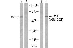 Western blot analysis of extracts from A431 cells, untreated or treated with EGF (200ng/ml 10min), using RelB (Ab-552) antibody (E021247, Line 1 and 2) and RelB (phospho-Ser552) antibody (E011255, Line 3 and 4). (RELB 抗体)