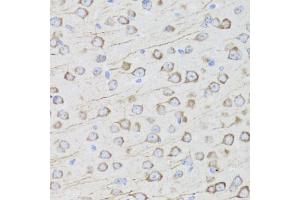 Immunohistochemistry of paraffin-embedded mouse brain using MIP antibody (ABIN5971491) at dilution of 1/100 (40x lens). (MIP 抗体)