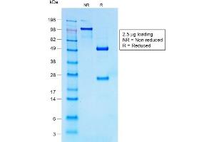 SDS-PAGE Analysis of Purified CD30 Rabbit Recombinant Monoclonal Antibody (Ki-1/1747R). (Recombinant TNFRSF8 抗体)