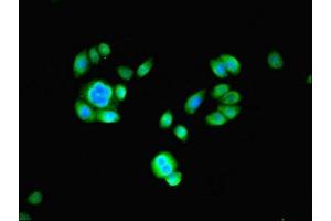 Immunofluorescent analysis of PC-3 cells using ABIN7164973 at dilution of 1:100 and Alexa Fluor 488-congugated AffiniPure Goat Anti-Rabbit IgG(H+L) (PSMB2 抗体  (AA 1-201))