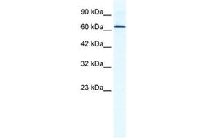 Western Blotting (WB) image for anti-DEAD (Asp-Glu-Ala-Asp) Box Polypeptide 21 (DDX21) antibody (ABIN2461344) (DDX21 抗体)