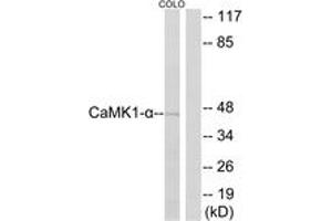 Western Blotting (WB) image for anti-Calcium/calmodulin-Dependent Protein Kinase I (CAMK1) (AA 143-192) antibody (ABIN2888788) (CAMK1 抗体  (AA 143-192))