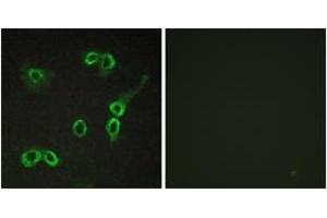 Immunofluorescence analysis of COS7 cells, using C3AR1 Antibody. (C3AR1 抗体  (AA 175-224))