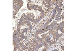 IHC analysis of RBMS1 using anti-RBMS1 antibody (ABIN7601195).