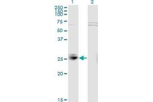 Western Blotting (WB) image for anti-Methionine Sulfoxide Reductase A (MSRA) (AA 1-100) antibody (ABIN3071463)