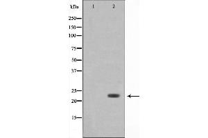 Western blot analysis on 293 cell lysate using Bak Antibody,The lane on the left is treated with the antigen-specific peptide. (BAK1 抗体  (N-Term))