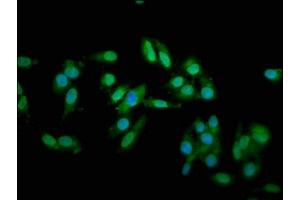 Immunofluorescence staining of Hela cells with ABIN7173586 at 1:66, counter-stained with DAPI. (Cardiac Troponin T2 抗体  (AA 138-298))