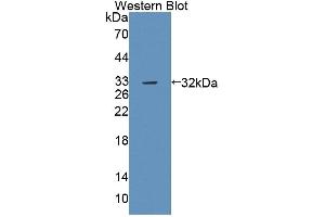 Western blot analysis of the recombinant protein. (PTPRB 抗体  (AA 1214-1463))