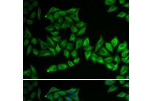 Immunofluorescence analysis of U2OS cells using TPMT Polyclonal Antibody (TPMT 抗体)