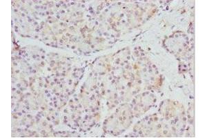 Immunohistochemistry of paraffin-embedded human pancreatic tissue using ABIN7168685 at dilution of 1:100 (FRZB 抗体  (AA 166-325))