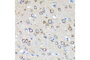 Immunohistochemistry of paraffin-embedded rat brain using Huntingtin Rabbit mAb (ABIN7267793) at dilution of 1:100 (40x lens). (Huntingtin 抗体)