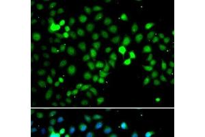 Immunofluorescence analysis of A549 cells using MTF2 Polyclonal Antibody (MTF2 抗体)