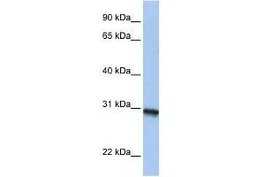 WB Suggested Anti-C20orf195 Antibody Titration: 0.