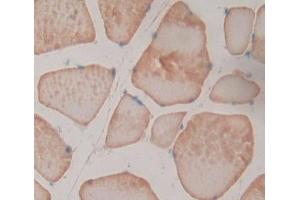 Used in DAB staining on fromalin fixed paraffin- embedded skeletal muscle tissue (NT5M 抗体  (AA 30-209))