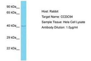 Image no. 1 for anti-Coiled-Coil Domain Containing 94 (CCDC94) (AA 239-288) antibody (ABIN6750639) (CCDC94 抗体  (AA 239-288))