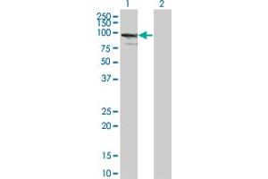 Western Blot analysis of ZNF274 expression in transfected 293T cell line by ZNF274 monoclonal antibody (M01), clone 4C12. (ZNF274 抗体  (AA 420-530))