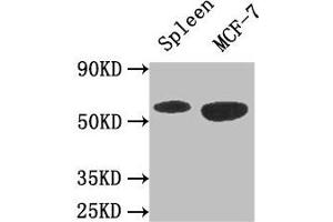 Western Blot Positive WB detected in: Mouse spleen tissue, MCF-7 whole cell lysate All lanes: AMPK1 antibody at 3 μg/mL Secondary Goat polyclonal to rabbit IgG at 1/50000 dilution Predicted band size: 65, 66 kDa Observed band size: 65 kDa