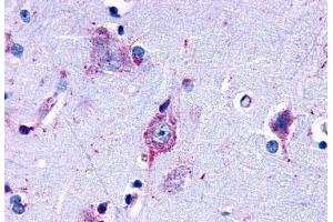 Anti-EDG7 antibody  ABIN1048537 IHC staining of human brain, amygdala. (LPAR3 抗体  (Cytoplasmic Domain))
