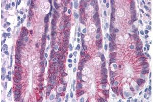 Human Small Intestine: Formalin-Fixed, Paraffin-Embedded (FFPE) (ASAH2 抗体  (C-Term))