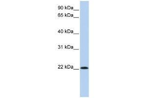 WB Suggested Anti-RNASE11 Antibody Titration: 0. (RNASE11 抗体  (Middle Region))