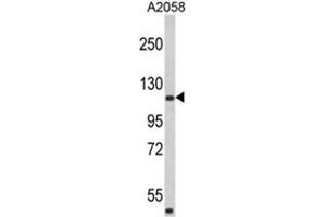 Western blot analysis of HMHA1 Antibody (Center) in A2058 cell line lysates (35ug/lane). (HMHA1 抗体  (Middle Region))