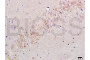 Formalin-fixed and paraffin embedded: rat brain tissue labeled with Anti-Nogo-A Polyclonal Antibody (ABIN725480), Unconjugated at 1:200 followed by conjugation to the secondary antibody and DAB staining (Reticulon 4 抗体  (AA 301-400))