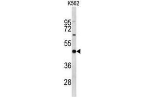 Western blot analysis of EIF4A2 Antibody (C-term) in K562 cell line lysates (35µg/lane). (EIF4A2 抗体  (C-Term))