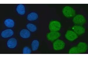 IF analysis of KHSRP using anti-KHSRP antibody (ABIN7599775).