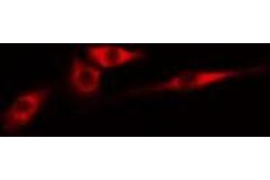 ABIN6274981 staining Hela cells by IF/ICC. (CDC42EP4 抗体  (Internal Region))