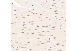 Immunohistochemistry of paraffin embedded mouse heart using SUPT3H (ABIN7075767) at dilution of 1: 1500 (400x lens) (SUPT3H/SPT3 抗体)