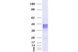 Western Blotting (WB) image for RAD9 Homolog A (S. Pombe) (RAD9A) protein (Myc-DYKDDDDK Tag) (ABIN2730420)