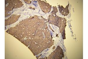 Immunohistochemistry (IHC) image for anti-Keratin 19 (KRT19) (AA 386-399), (C-Term) antibody (ABIN870576) (Cytokeratin 19 抗体  (C-Term))