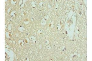 Immunohistochemistry of paraffin-embedded human brain tissue using ABIN7159841 at dilution of 1:100